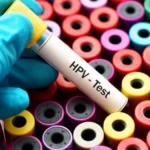 آزمایش اچ پی وی