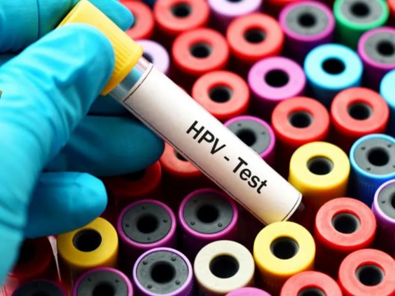 آزمایش اچ پی وی