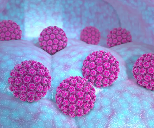 آیا ویروس HPV درمان می شود؟