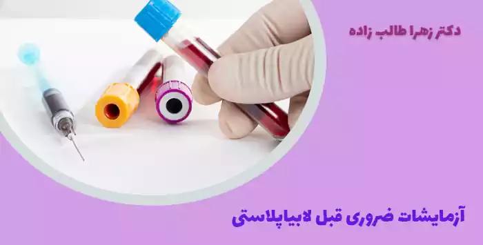 آزمایشات ضروری قبل لابیاپلاستی