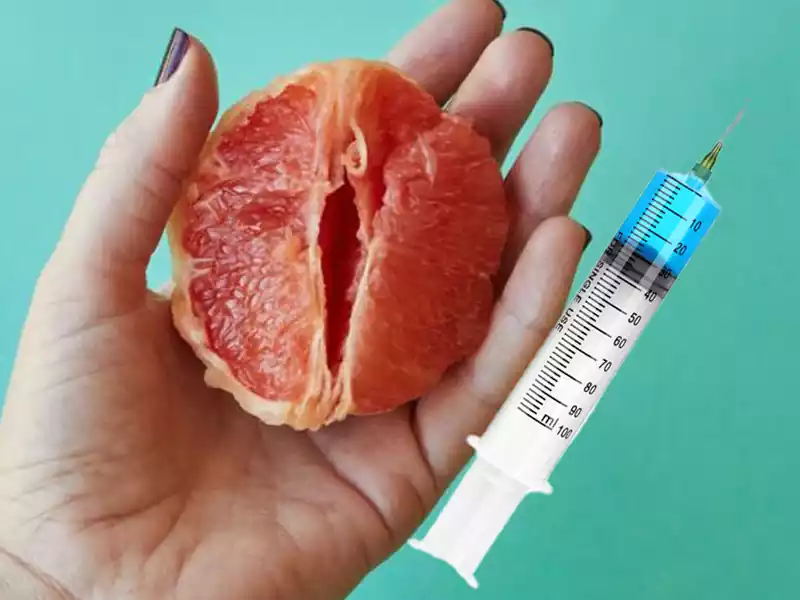 آزمایشات قبل از لابیاپلاستی