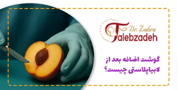 گوشت اضافه بعد از لابیاپلاستی چیست؟
