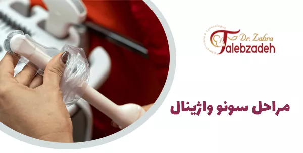 مراحل سونو واژینال