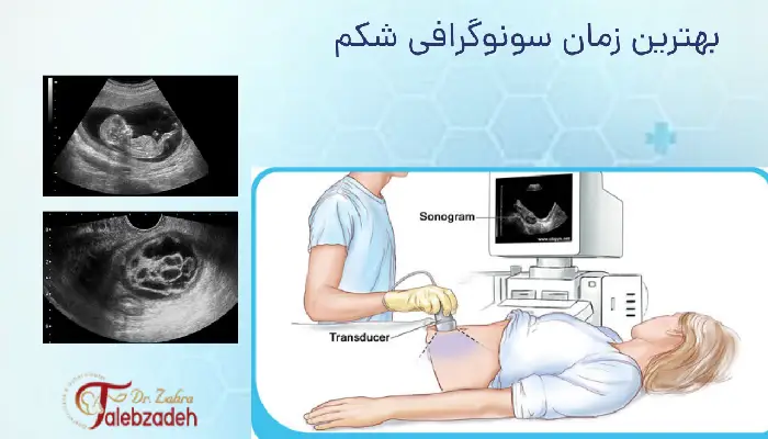 بهترین زمان سونوگرافی شکم