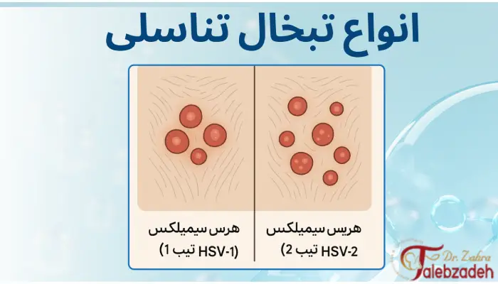 انواع تبخال تناسلی