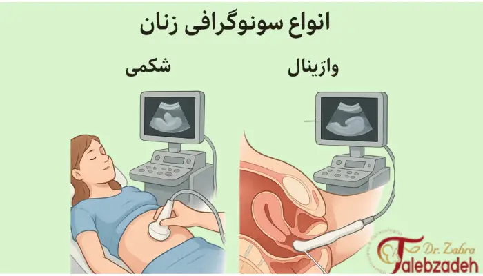 انواع سونوگرافی زنان