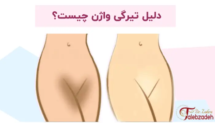 دلیل تیرگی واژن چیست؟