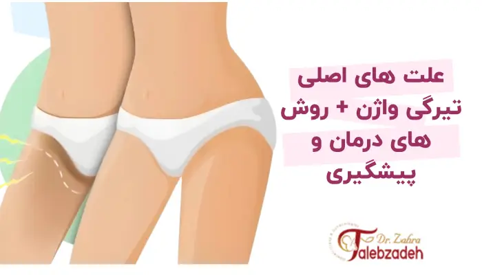 علت های اصلی تیرگی واژن + روش های درمان و پیشگیری