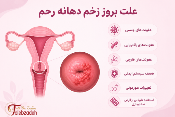 علت زخم دهانه رحم